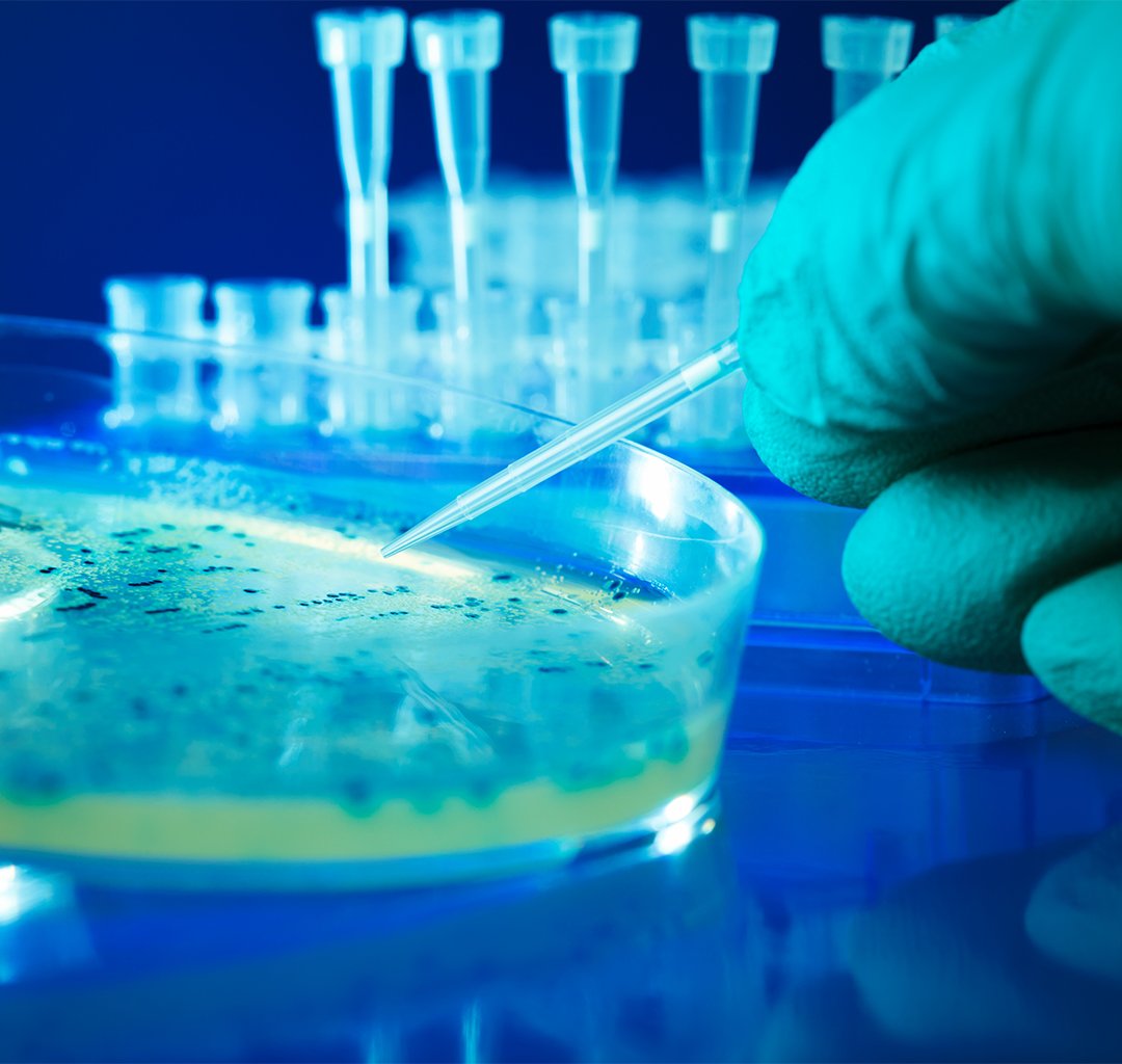 A gloved hand is using a pipette to handle a Petri dish containing a yellowish agar medium with bacterial colonies growing on it.