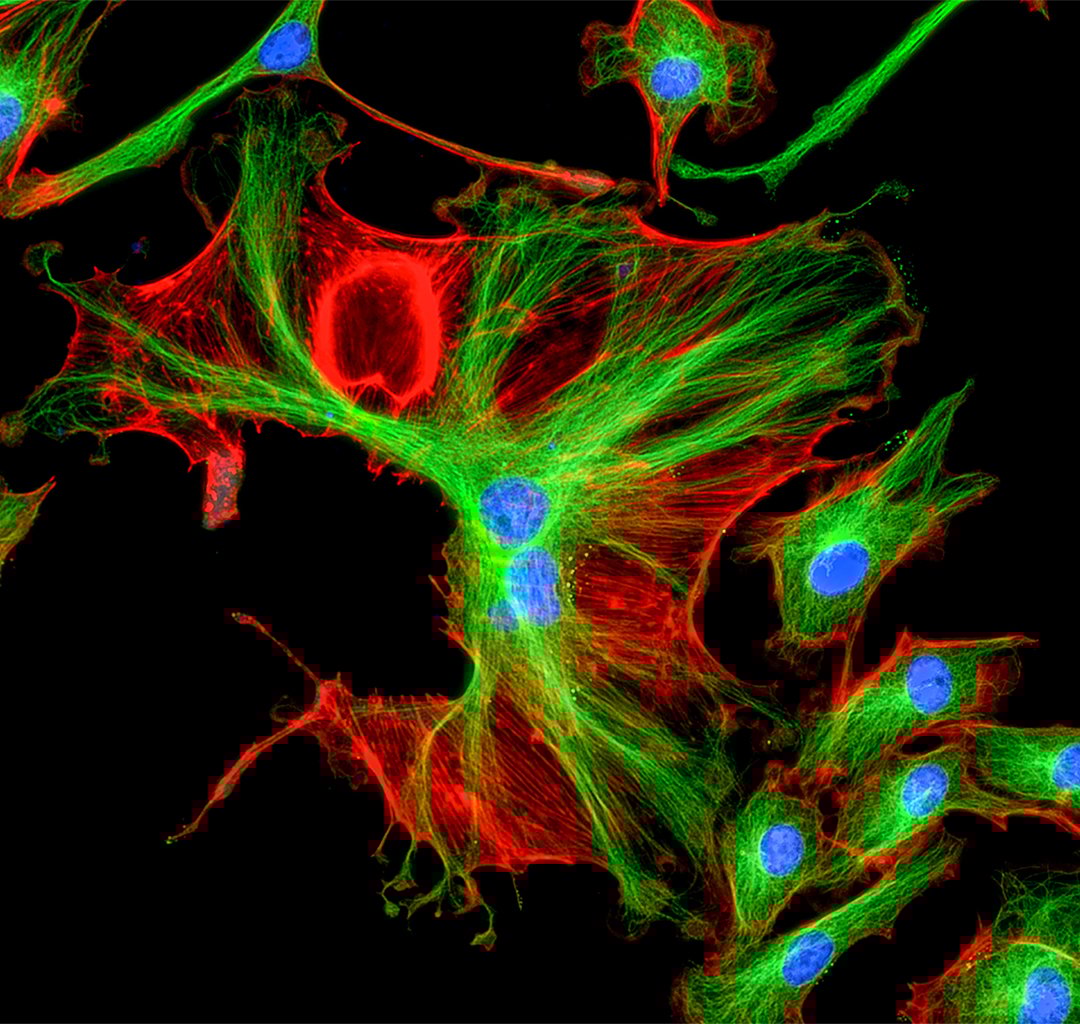 Fluorescence microscope image of cultured cells with their internal structures stained in different colors (Green, Blue and Red).